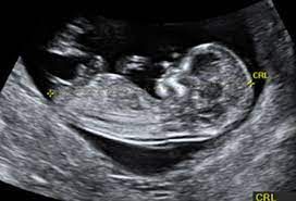 Rubén Chapa Téllez-0