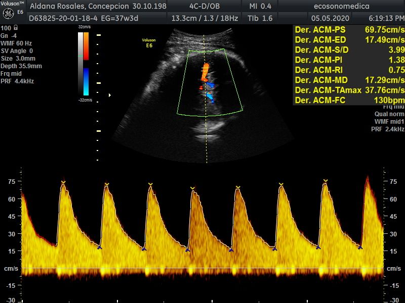 Héctor Bernardo Acevedo Manrique-20