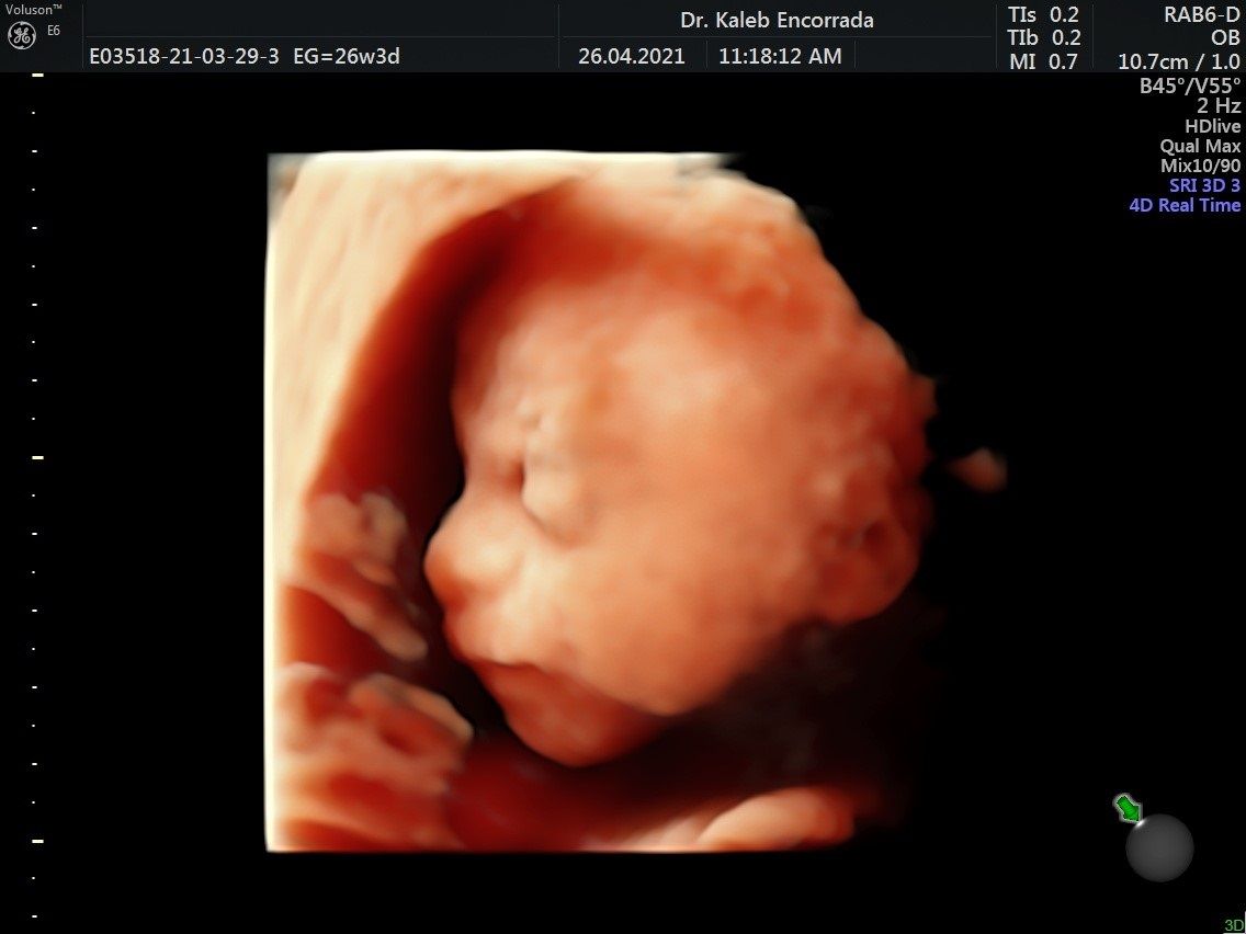 Hugo Kaleb Encorrada Luarca-20