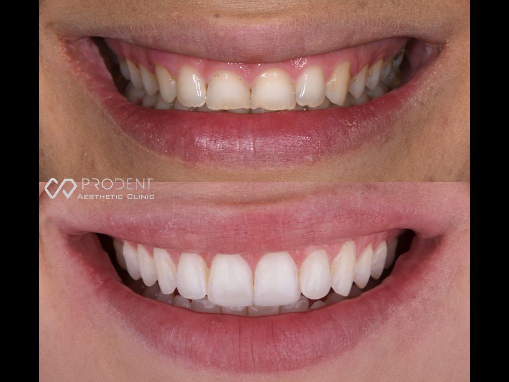 Ramiro Ivan Pérez Murillo-60