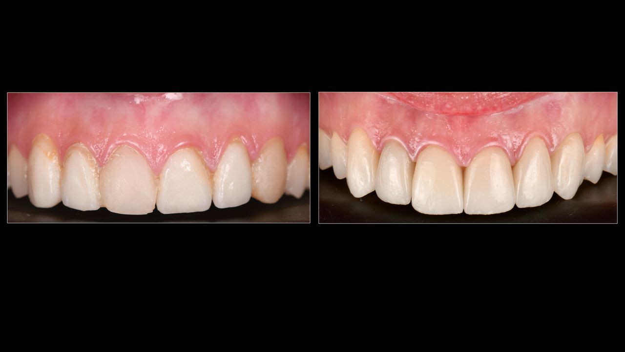 Ricardo López Lemus-52