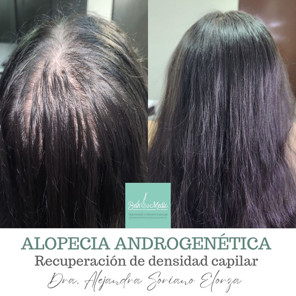 Alejandra Soriano Elorza-59