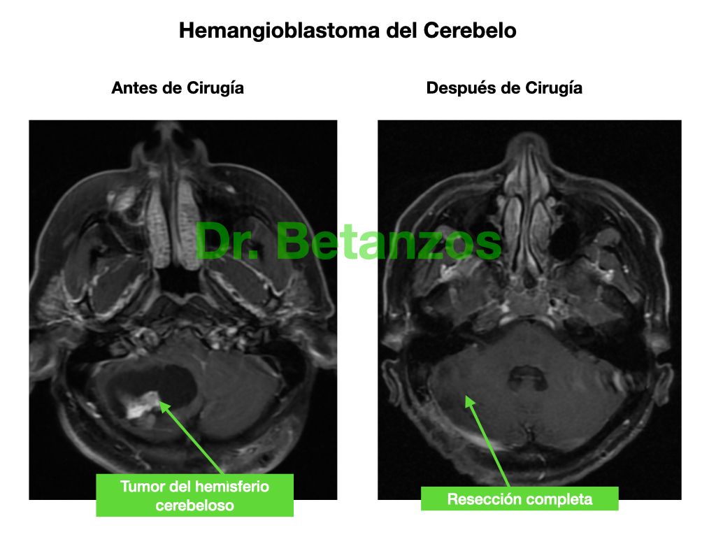Aleixandre Betanzos Villegas-18