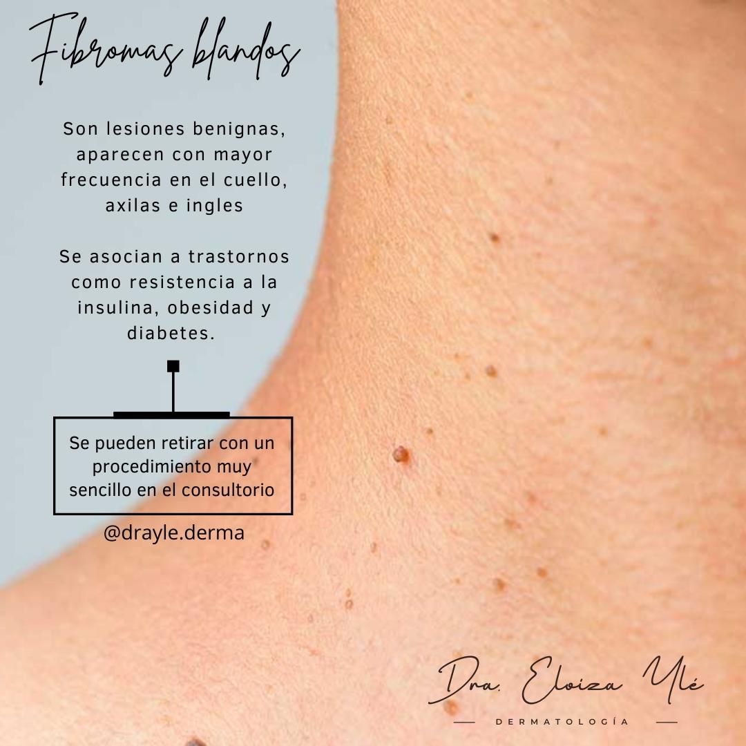 Eloiza Lizeth Ylé Arámburo-4