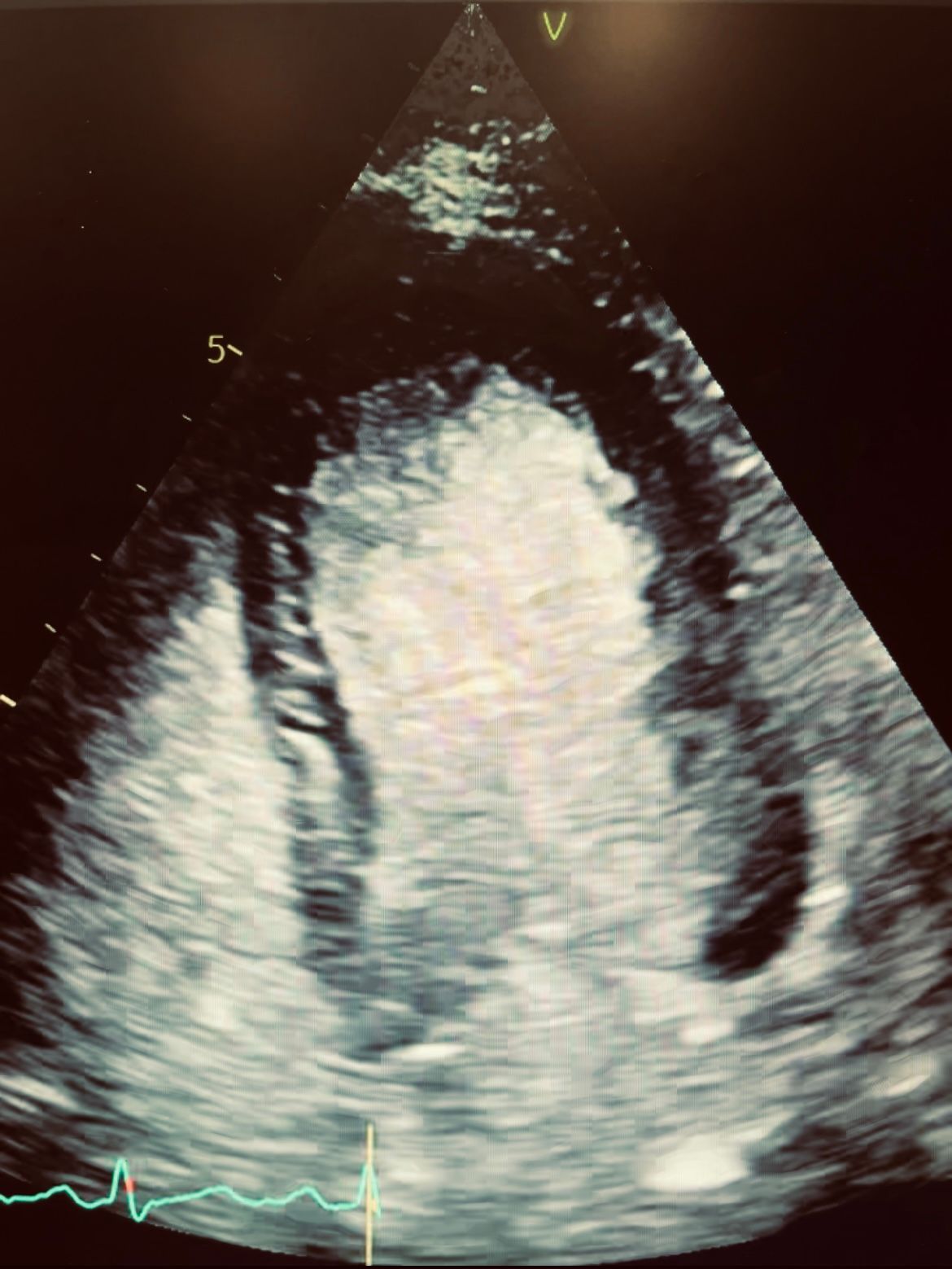 Francisco Javier Reyes Alvarez-4