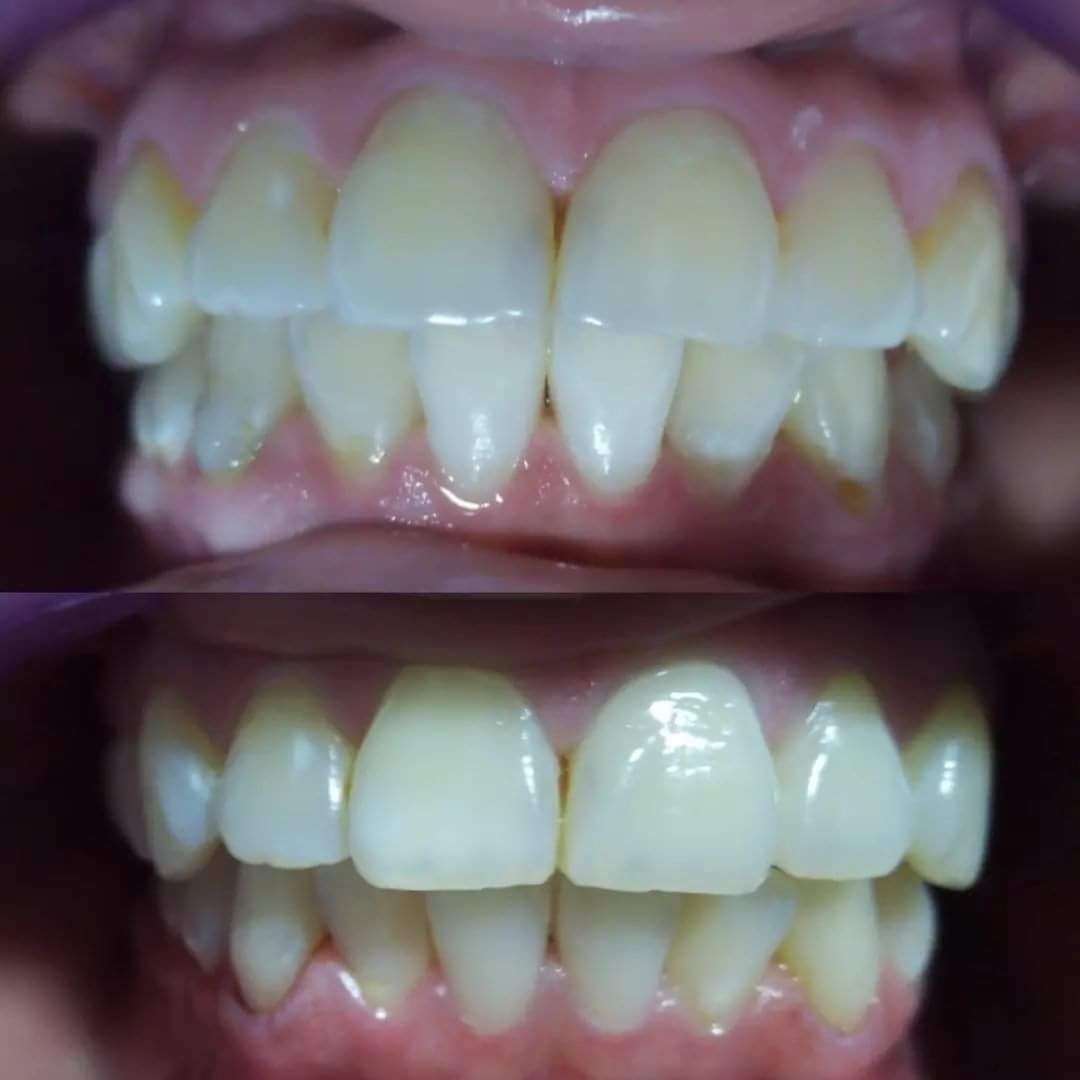 Jacqueline Nuñez Herrera-14