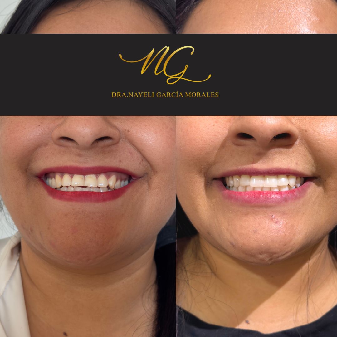 Nayeli Garcia Morales-5