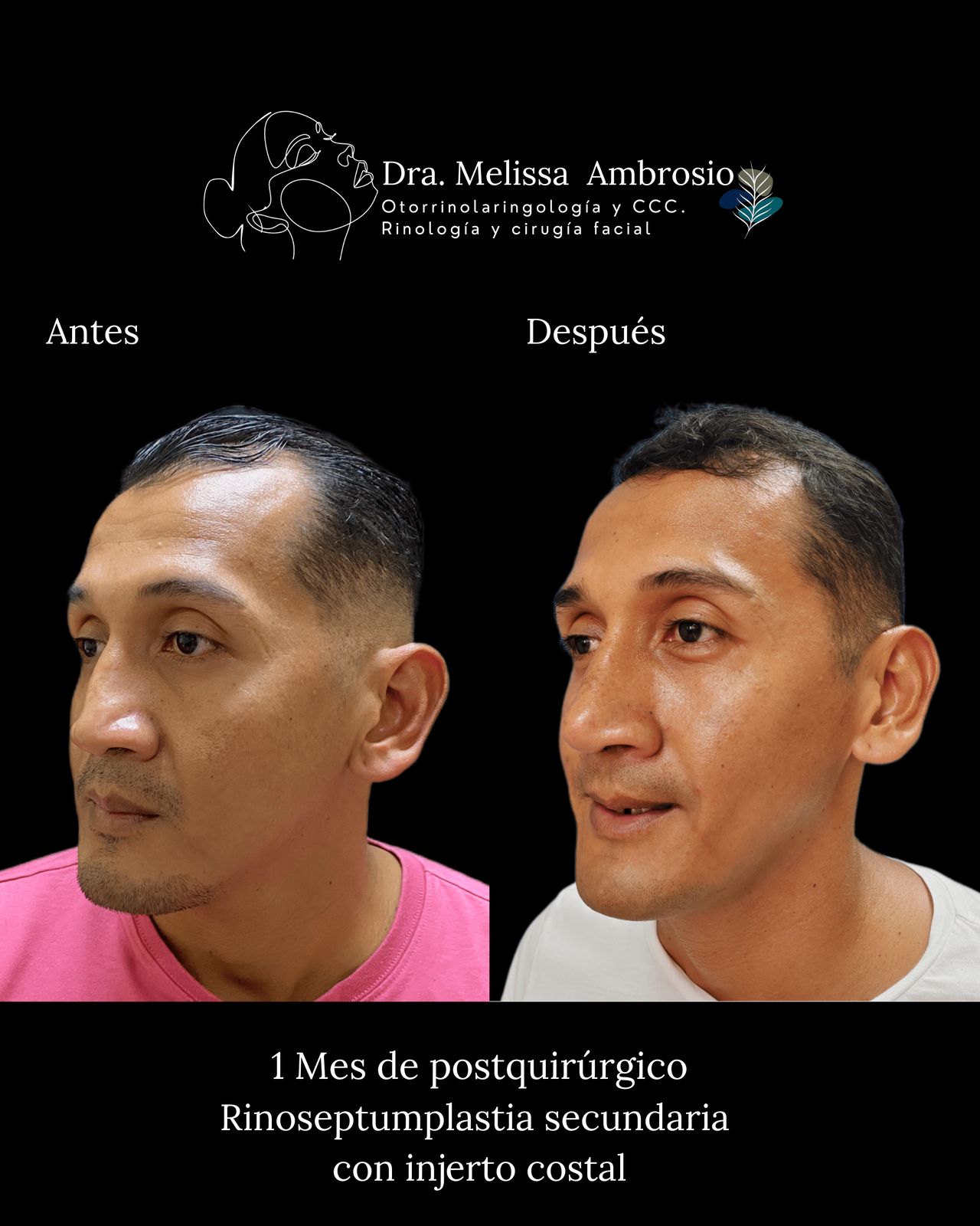 Melissa Guadalupe Ambrosio Mendoza-13