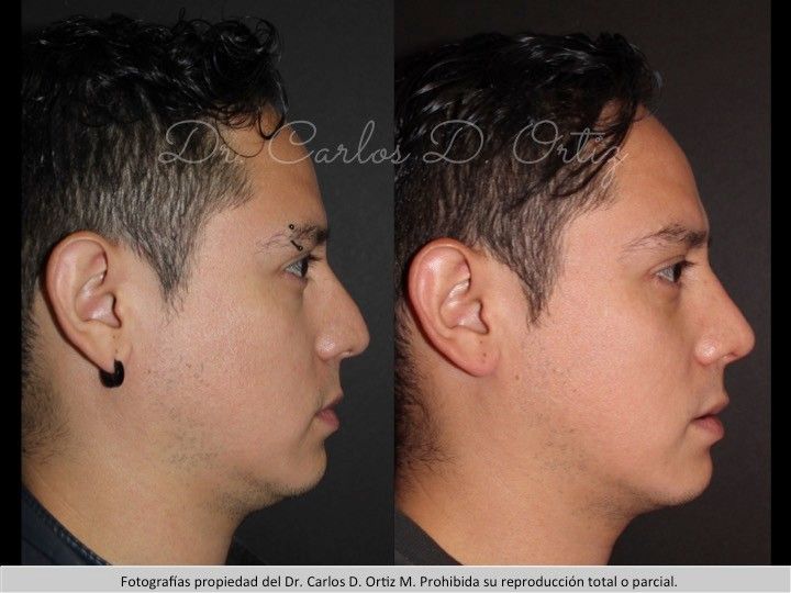 Carlos David Ortiz Moreno-3