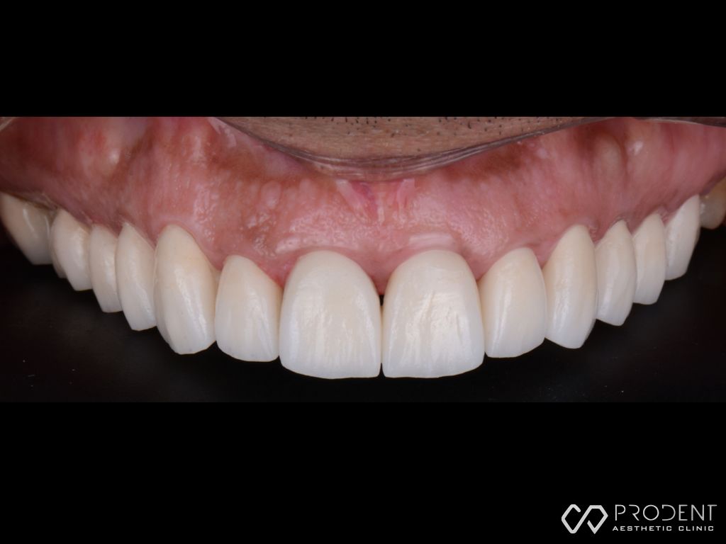 Ulises Pérez Murillo-95