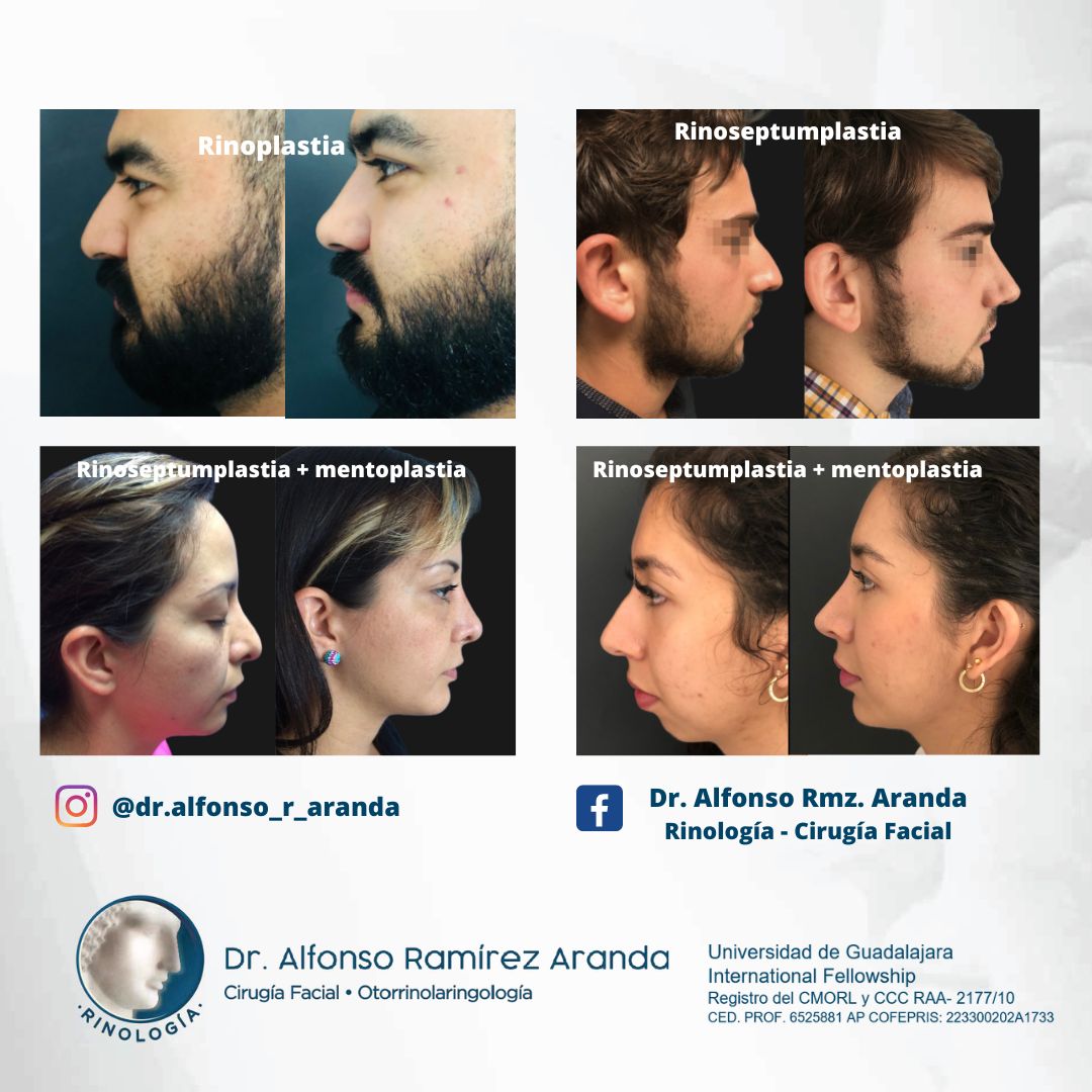 Alfonso Ramírez Aranda-2