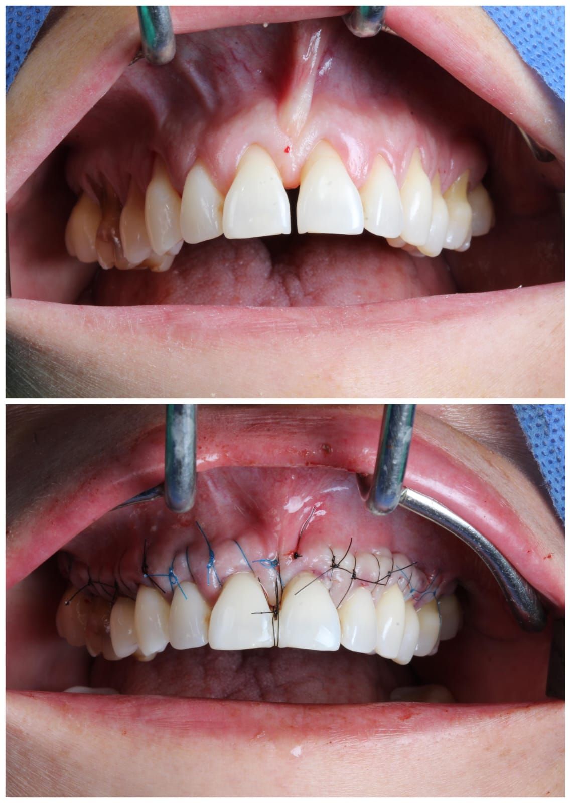 Hugo Enrique Aguilar Lamas-23