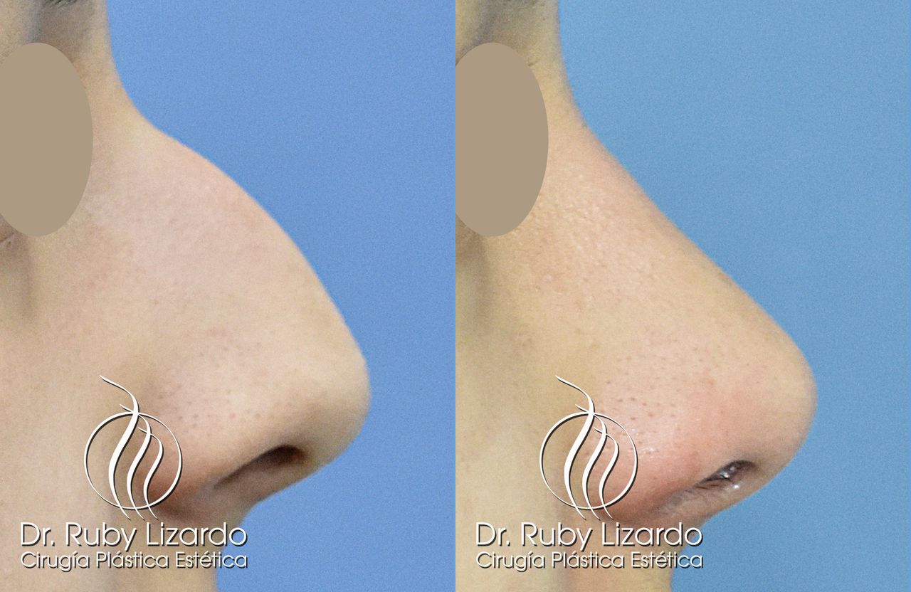 Ruby Lizardo Ramírez Robles-8