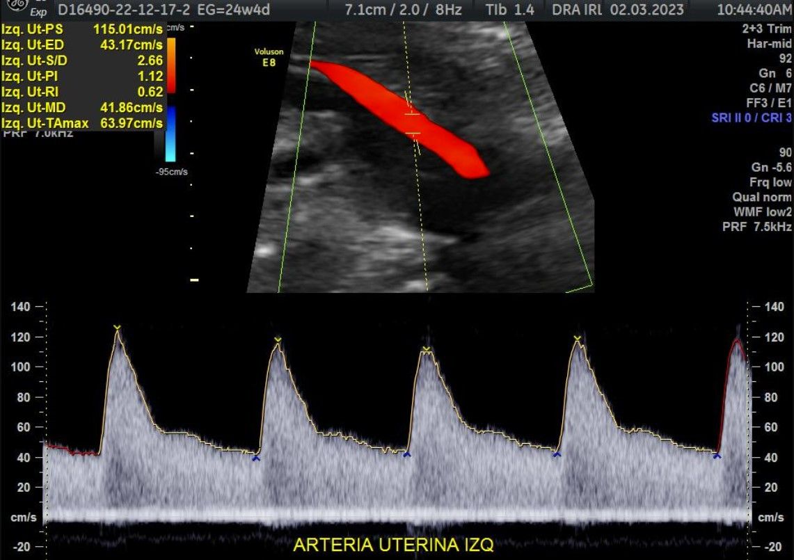 Irlanda Ayala Díaz-4