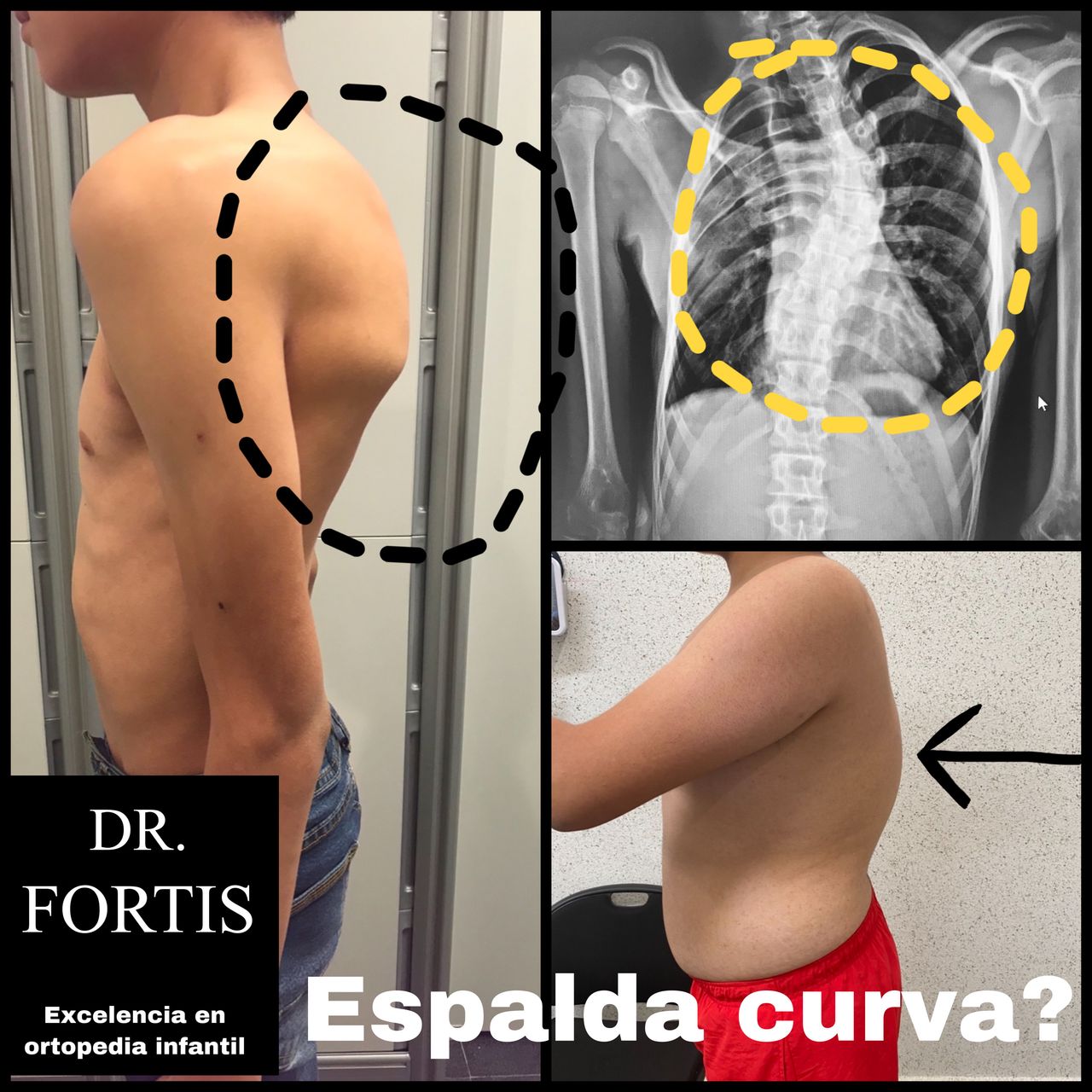 Ignacio Osvaldo Fortis Olmedo-11