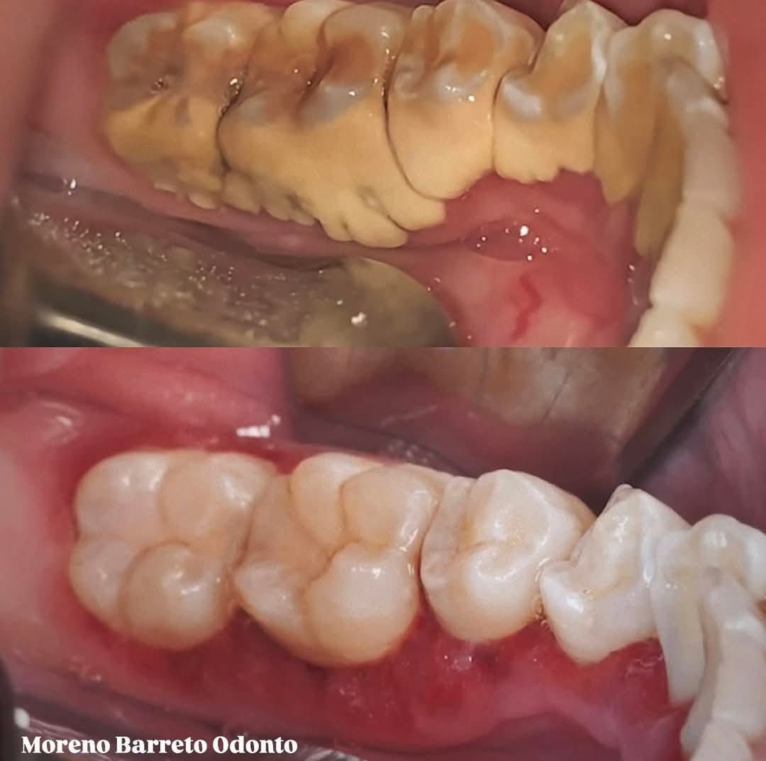 Apolo Espinoza Vega-6