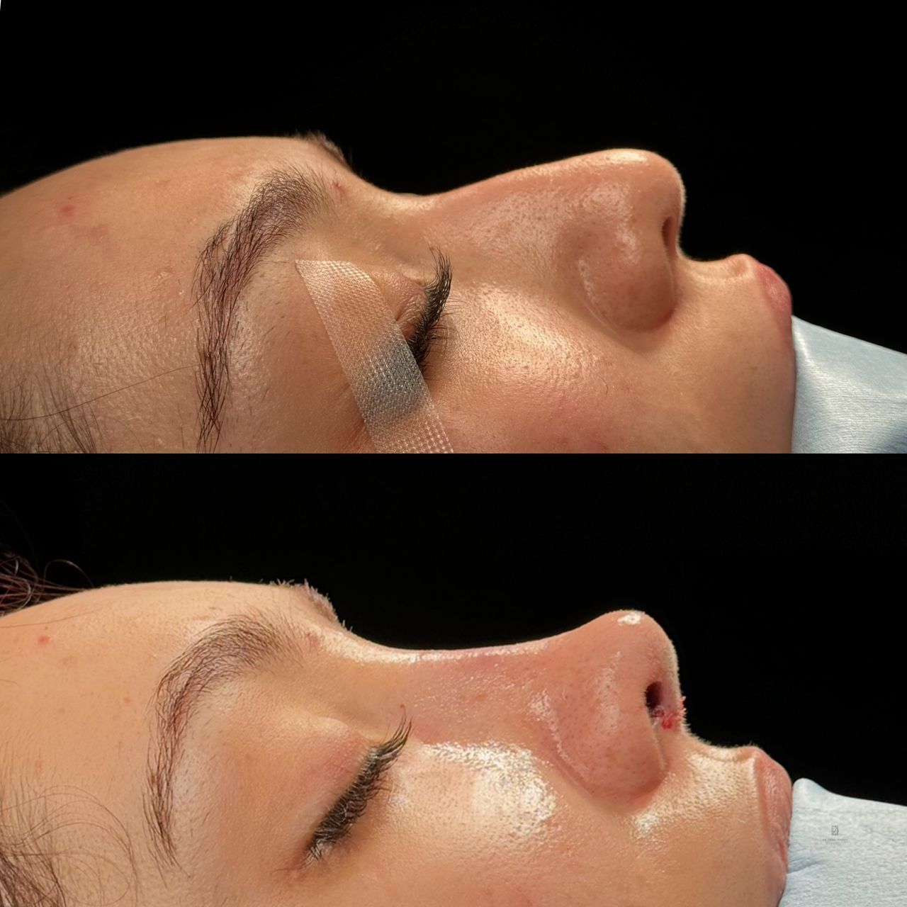 Angel Castro Urquizo-56