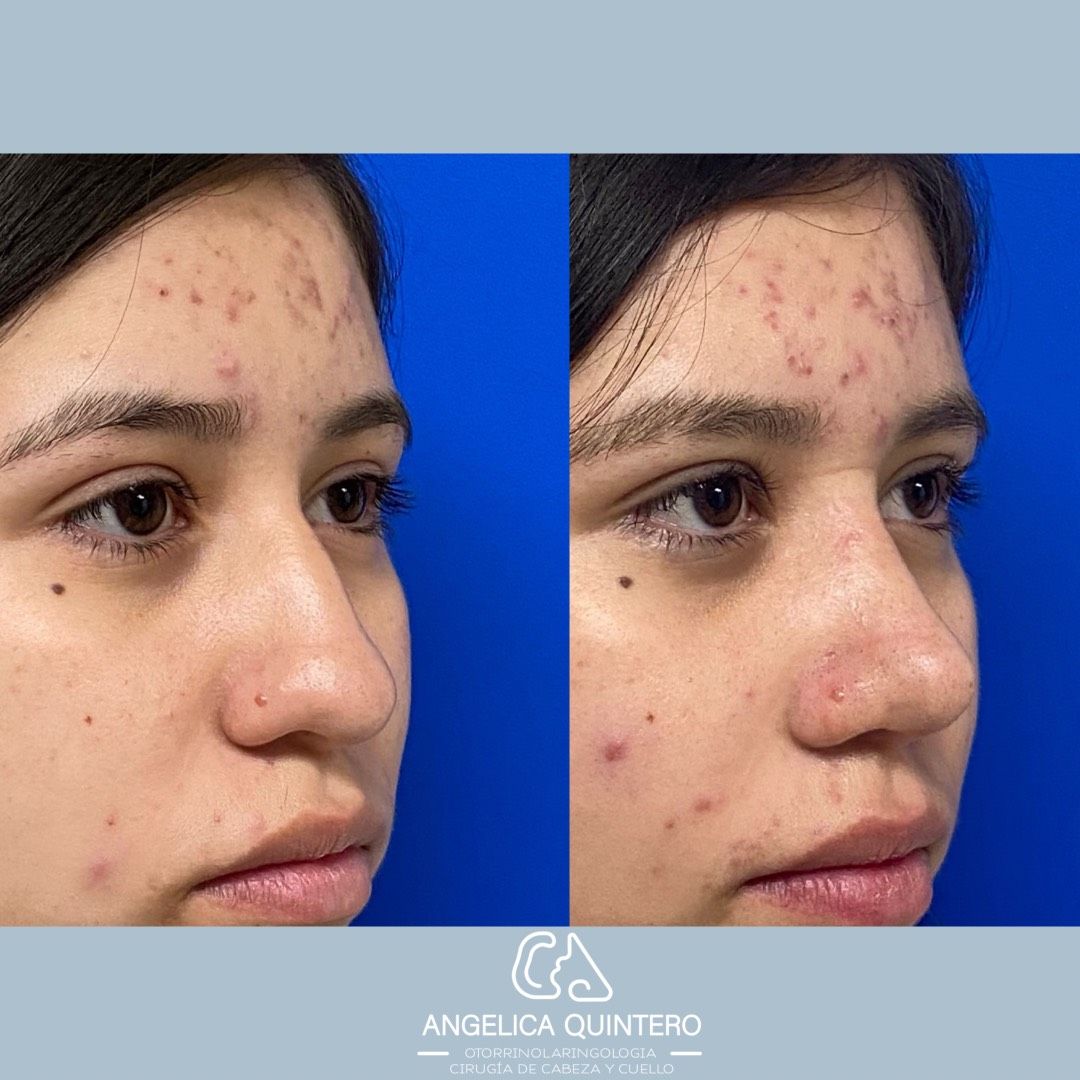 Angélica Gutiérrez Quintero-4