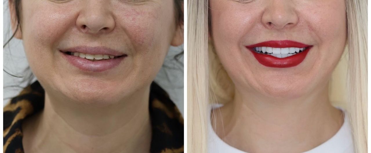 Nidya Irasema Gutierrez Garza-3