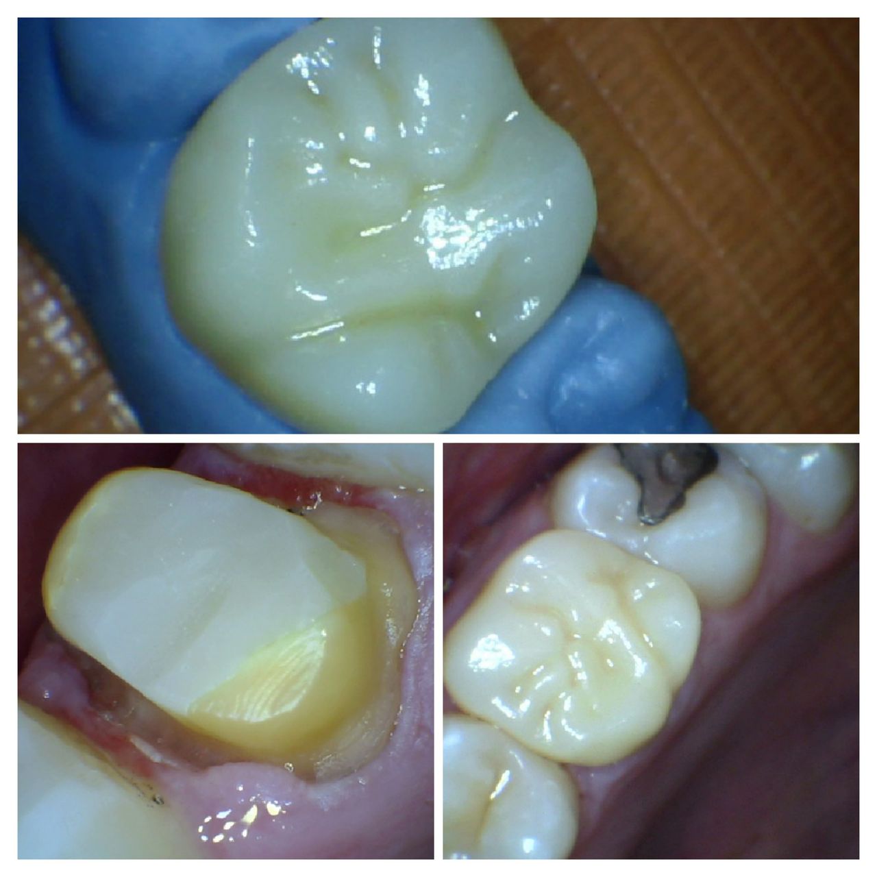 Jose David Torres Hernandez-12