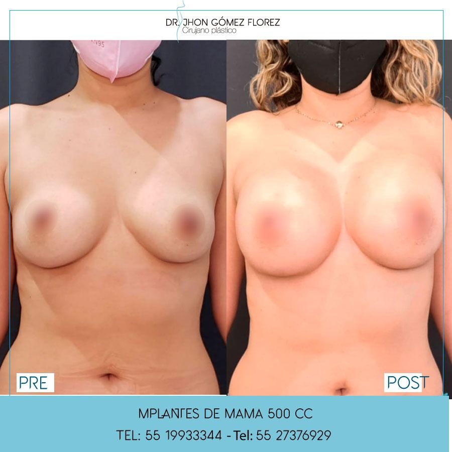 Jhon César Gómez Florez-18