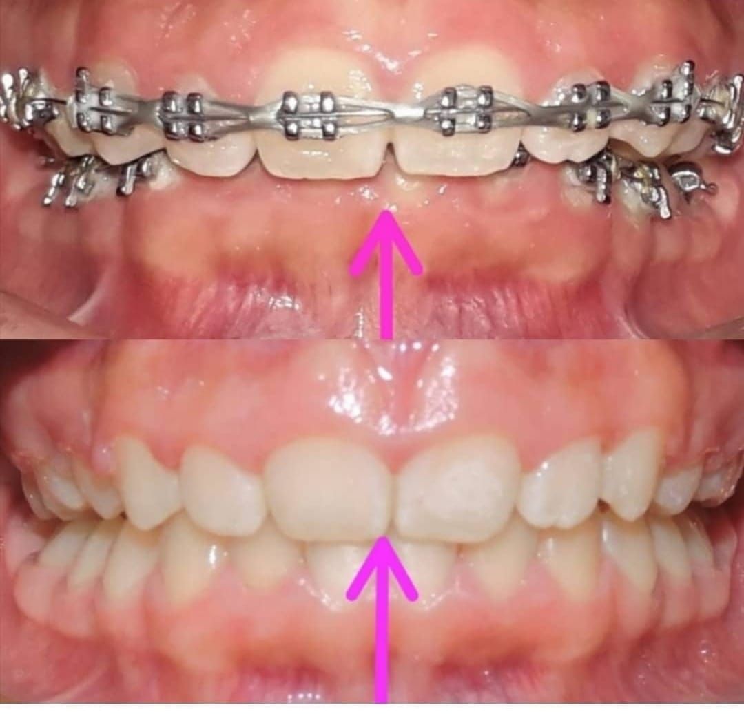 Tulia Andrade Rodriguez-17