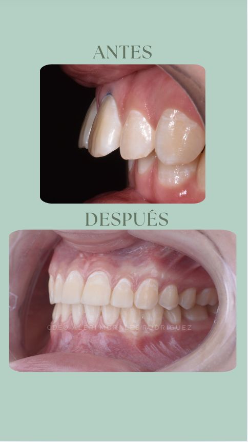 Alerí Morales Rodríguez-2