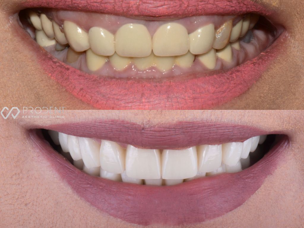 Ramiro Ivan Pérez Murillo-35