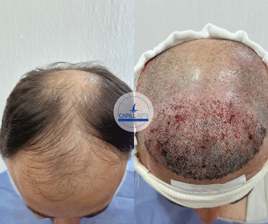 Adrian Hernandez Lopez-30