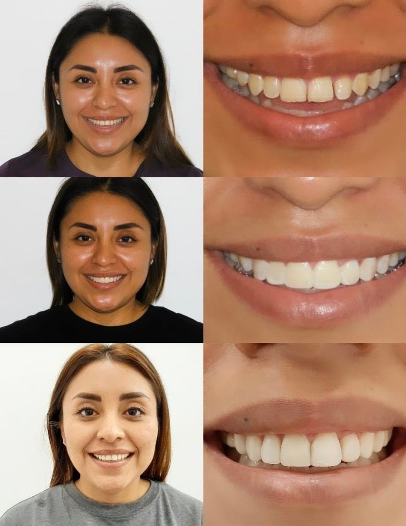 Ivan Torres Rascon-0