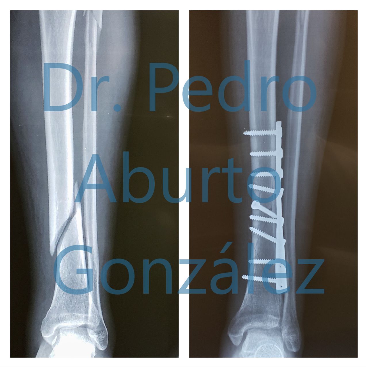 Pedro Aburto González-8
