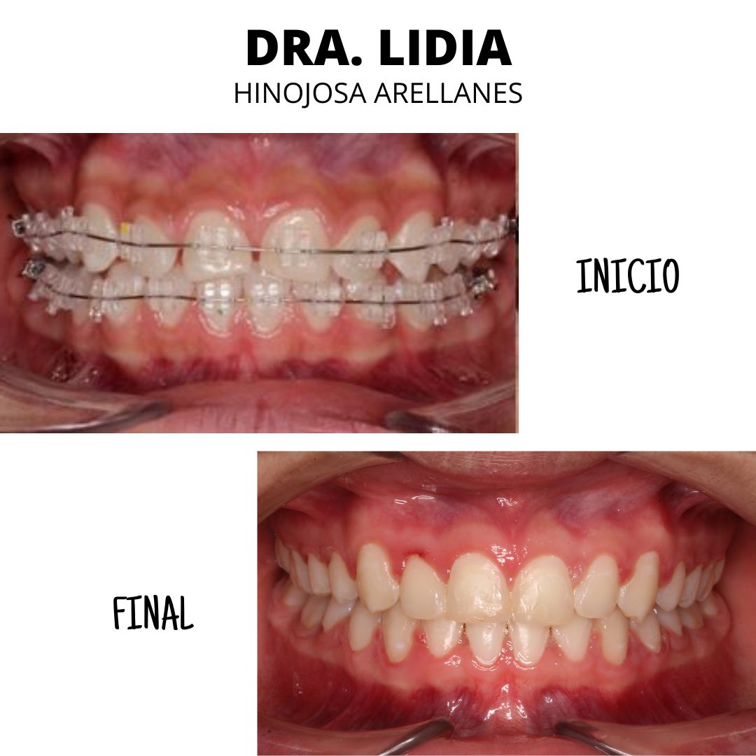 Lidia Abigail Hinojosa Arellanes-21