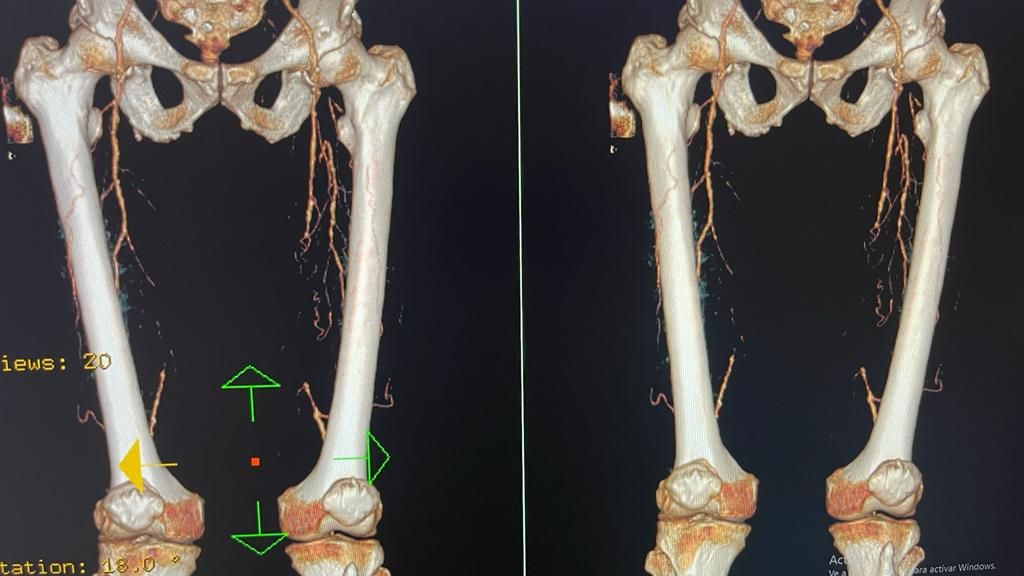 Jose Alfredo Valdovinos Estrada-1