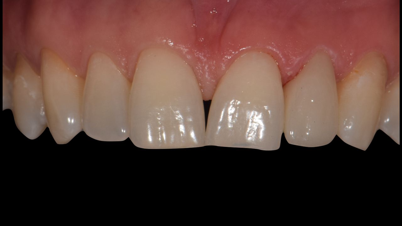 Luis Olvera Hernández-2