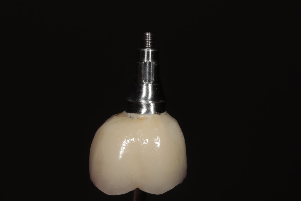 Mariel Itzayani Torres López-35