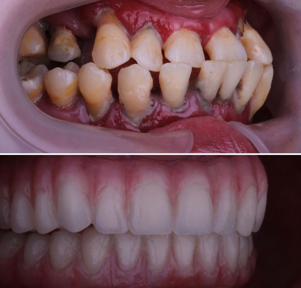 Josué Márquez Gómez-38