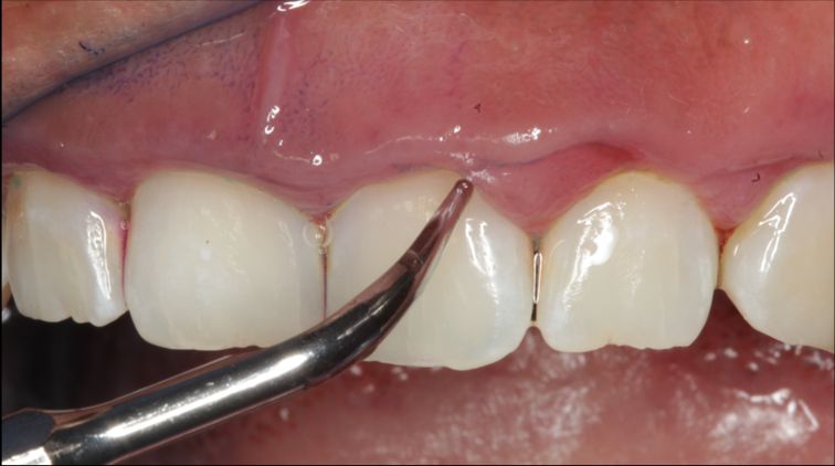 Agustin Salamanca Tapia-4