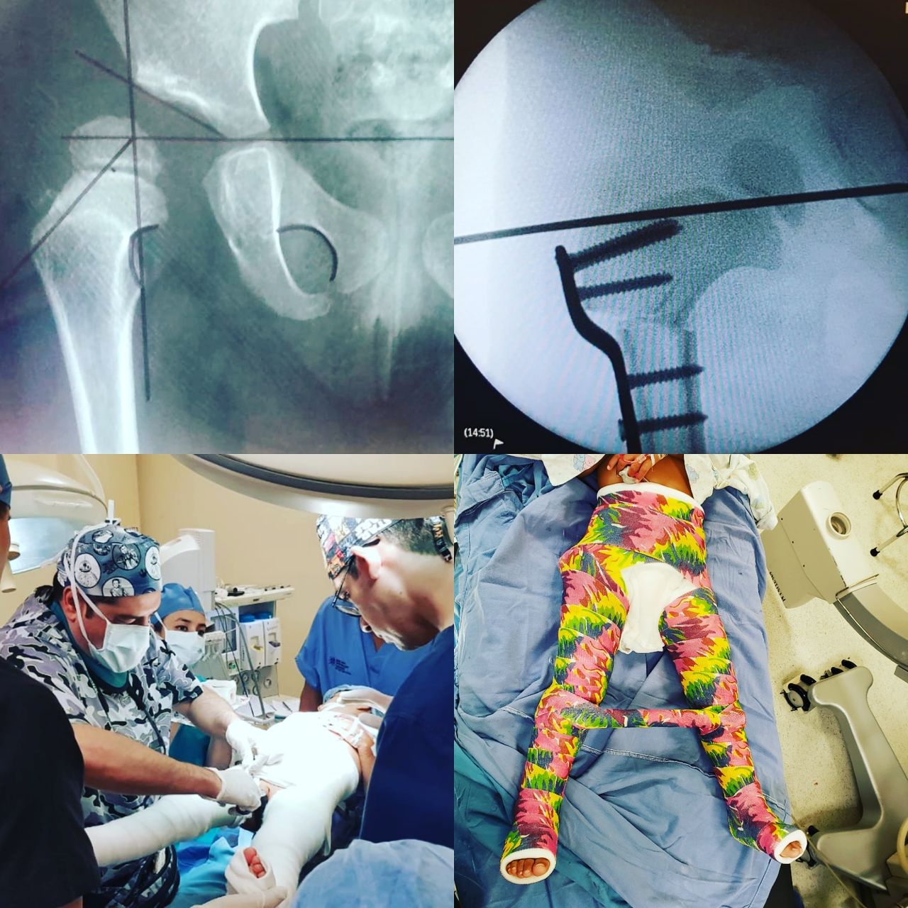 Alfonso Meza Vernis-68