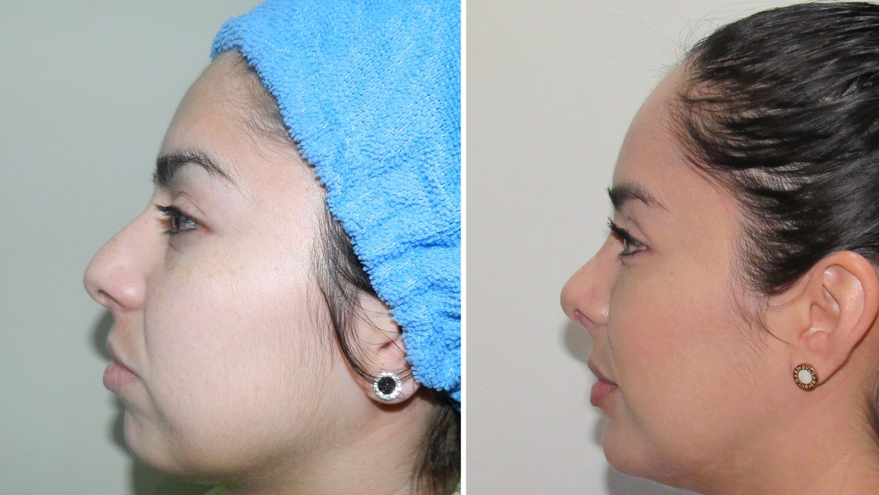 Rogelio Reza Gallegos-23