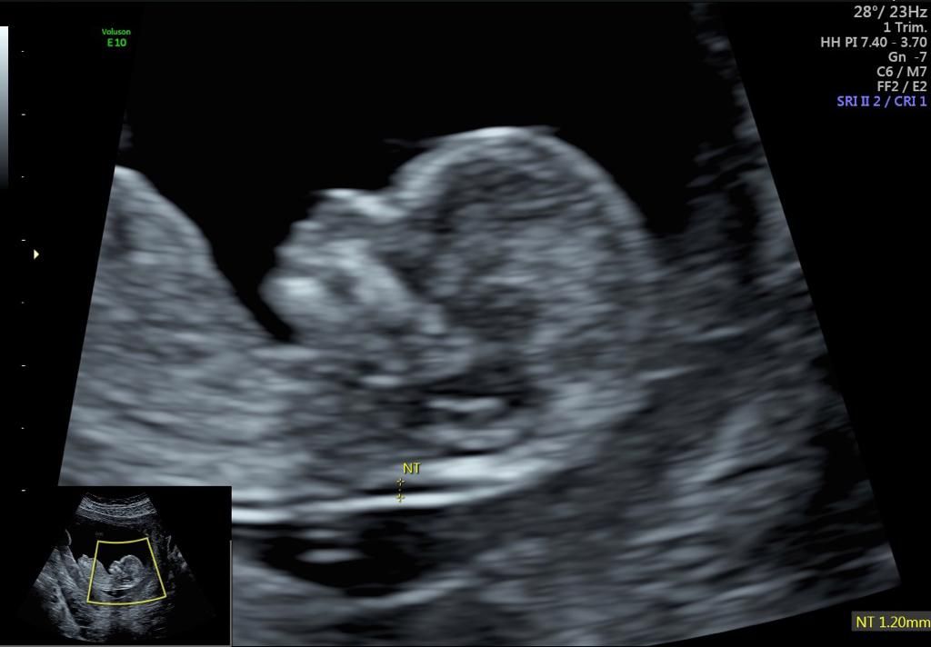 Juan Carlos De León-7