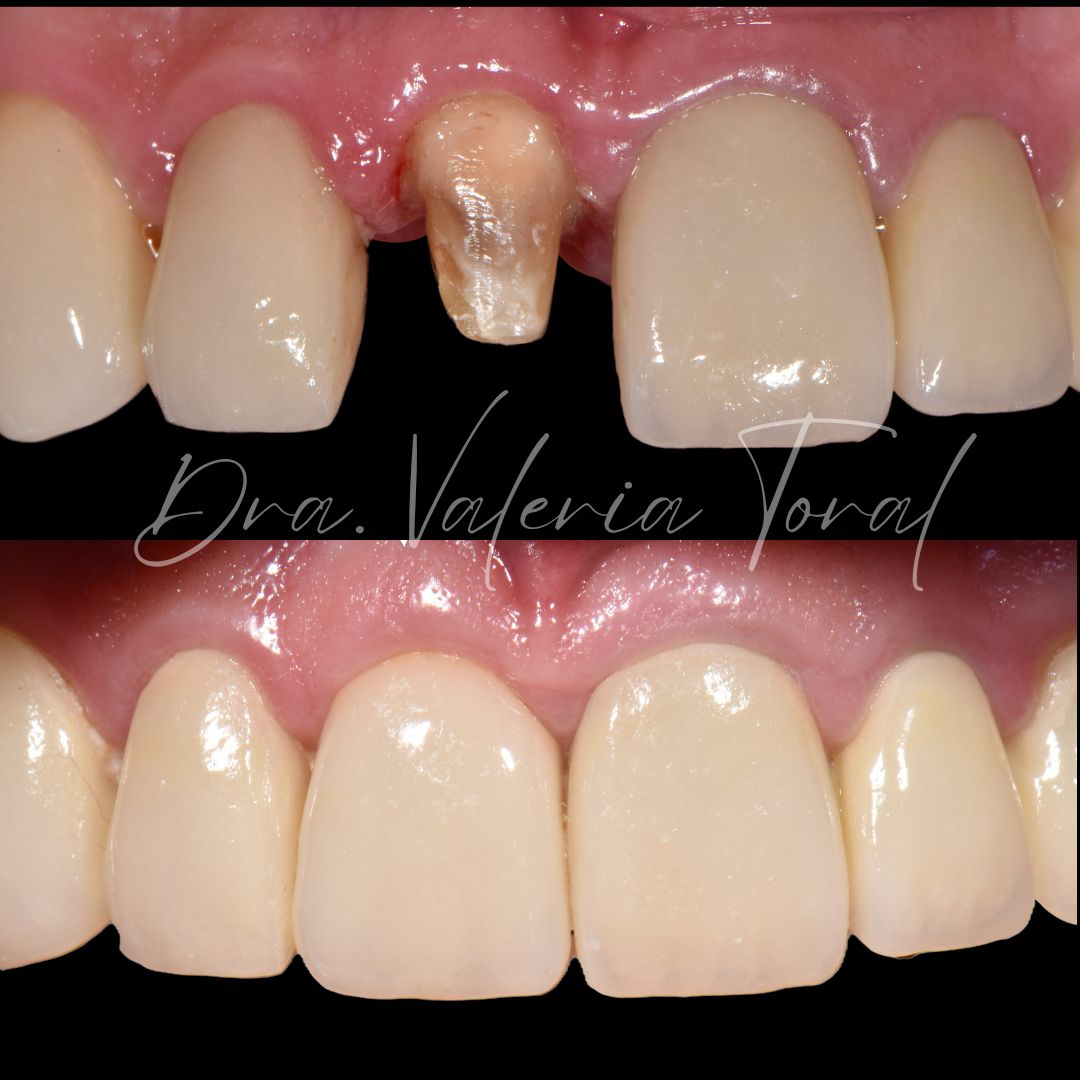 Valeria Montserrat Toral Ruiz-1