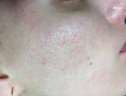 Jorge Luis Villalobos Ibarra-3