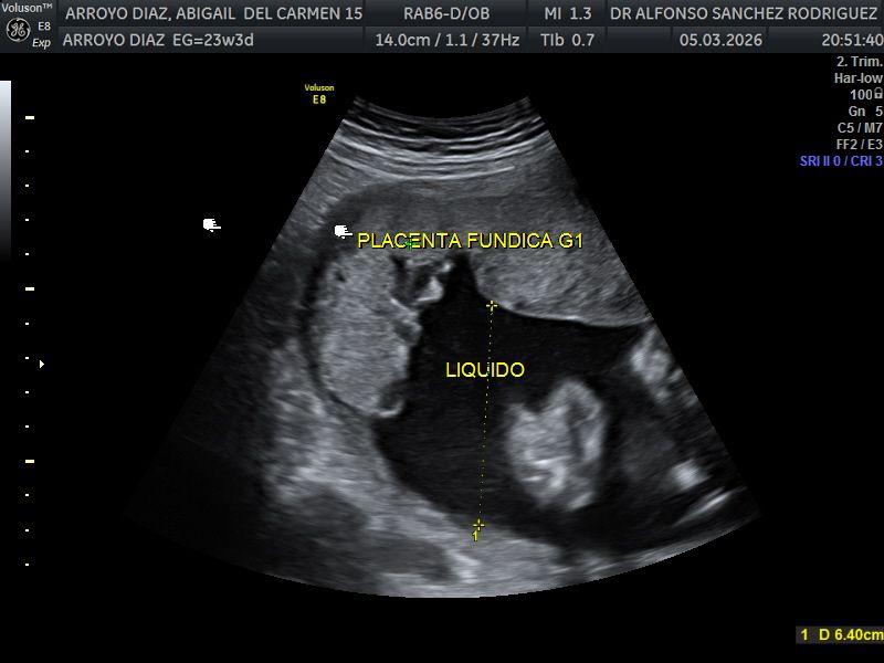 Alfonso Sanchez Rodriguez-57