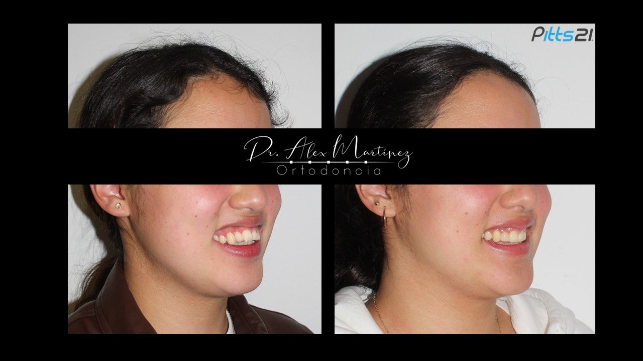 Alejandro Martínez Hernández-11