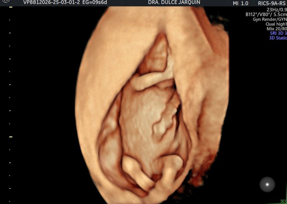 Dulce Anabel Jarquin Arango-29