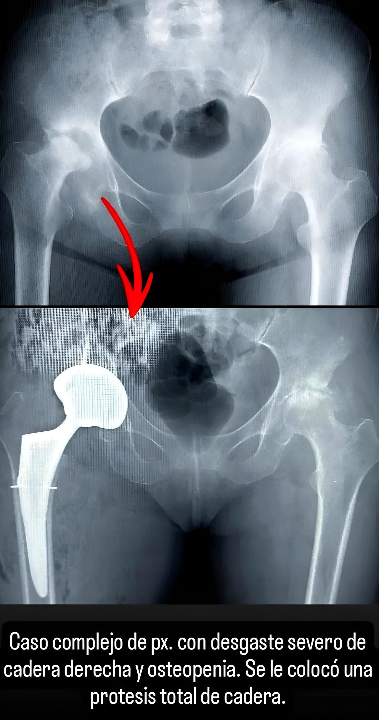 Noé Saavedra Islas-3