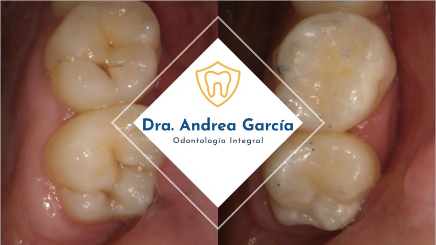 Andrea Hernández Garcia-11