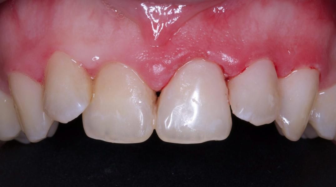 Esmeralda Candida Guerrero Pimentel-34