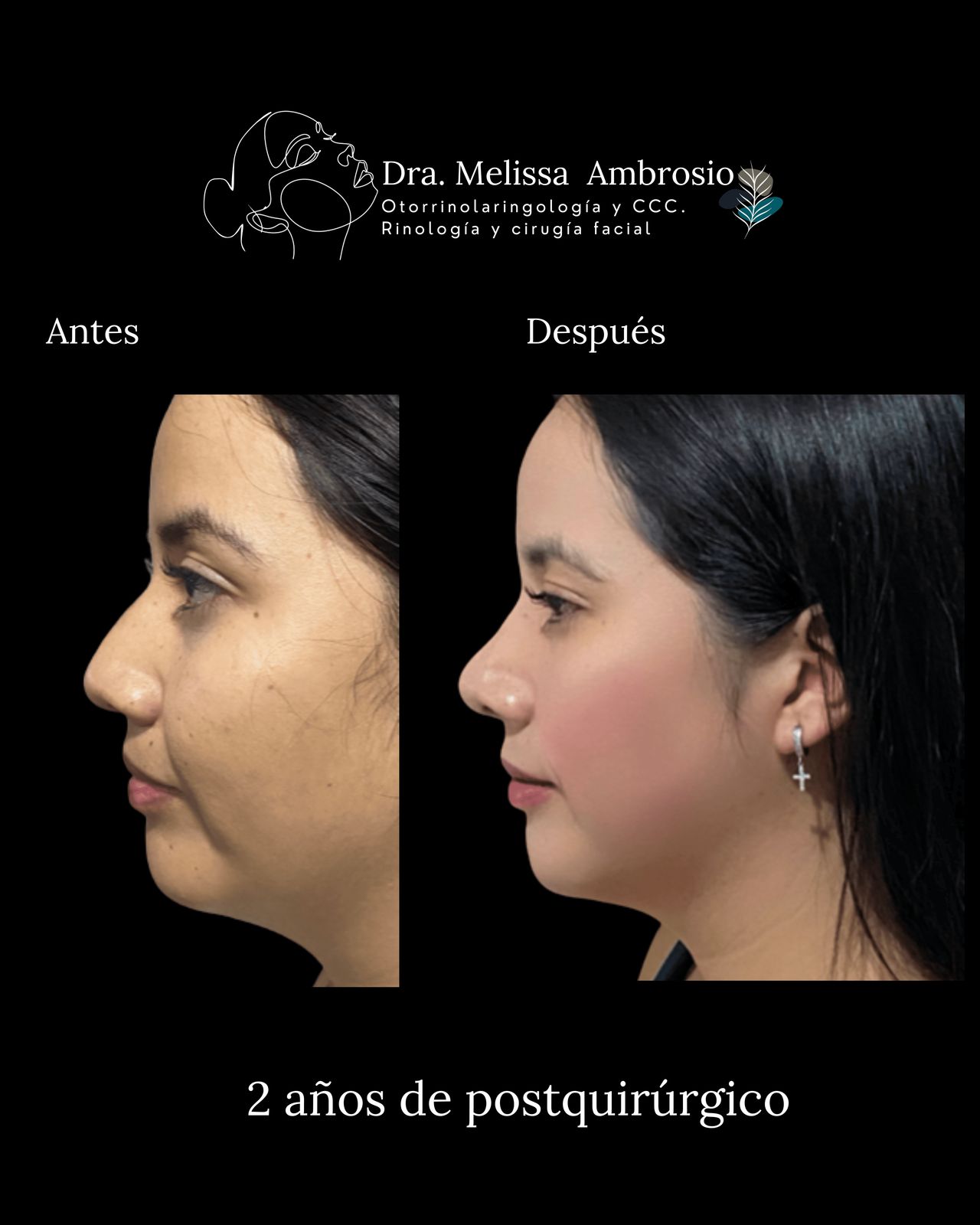 Melissa Guadalupe Ambrosio Mendoza-8