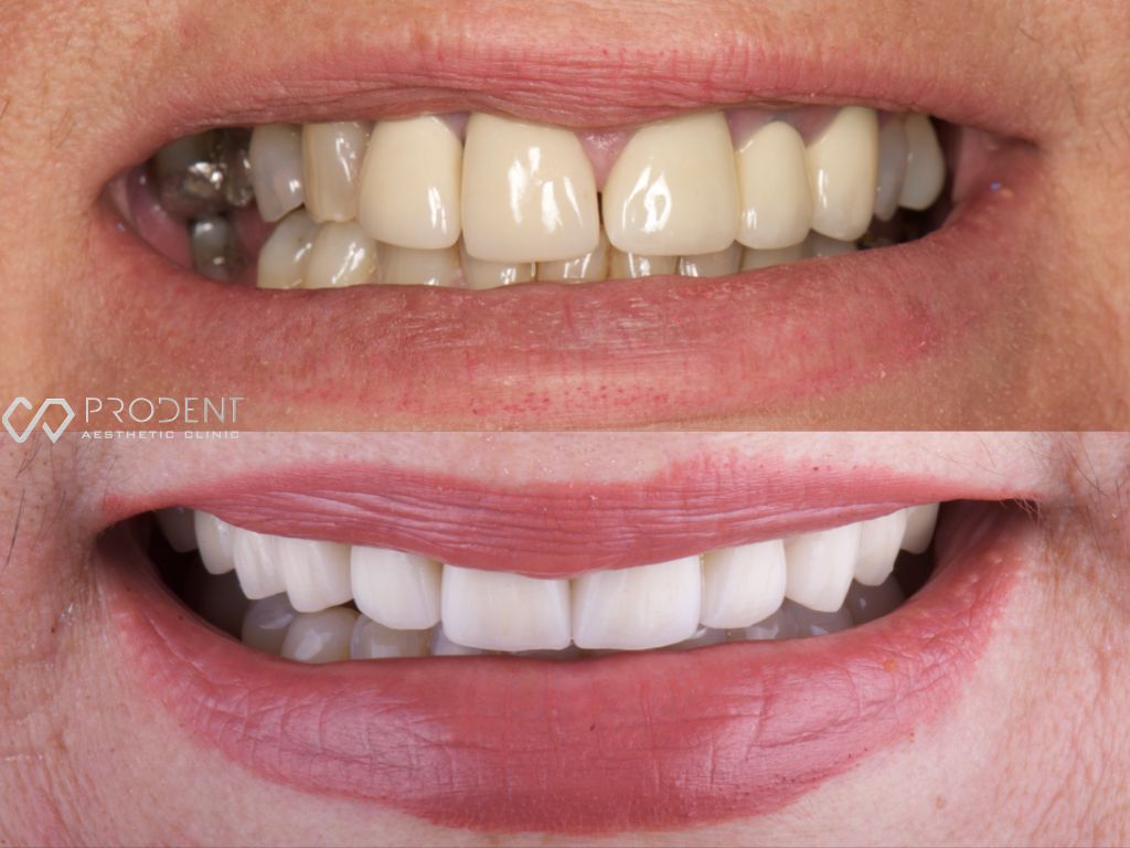 Ulises Pérez Murillo-32